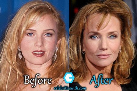 rebecca de mornay young|rebecca de mornay plastic surgery.